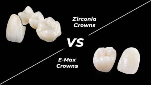 Zirkonyum mu E-max mi