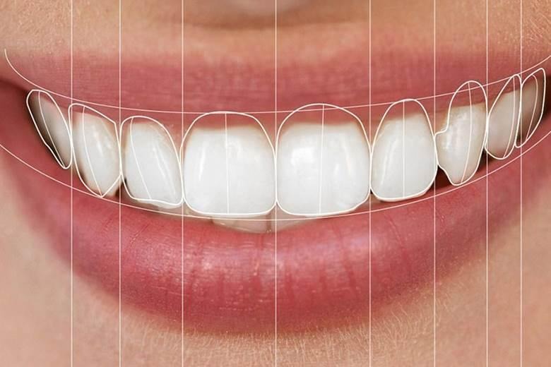 Digital Smile Design 2026: Kusursuz Bir Gülüş İçin Tedavi Öncesinde Sonuçları Görmek Mümkün mü?