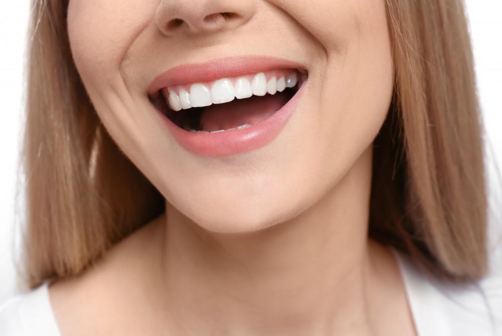Porselen Lamina ile Hollywood Smile İşlem Süreci ve Kalıcılık Süresi 2026 – Luna Dental Klinik