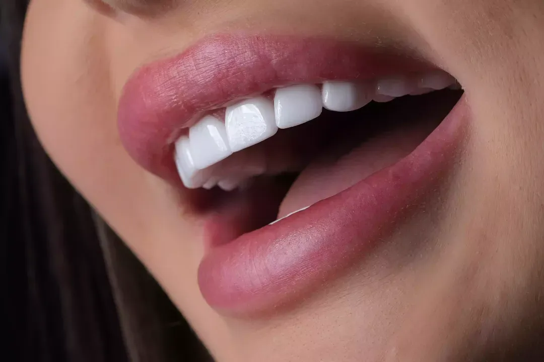 Gülüş Tasarımı ve Zirkonyum Kaplama Trendleri ile Kusursuz Estetik - Luna Dental Klinik