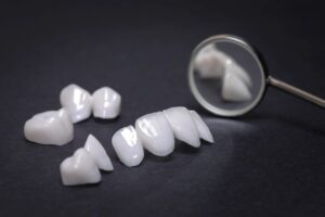 Gülüş Tasarımı ve Zirkonyum Kaplama Trendleri ile Kusursuz Estetik - Luna Dental Klinik